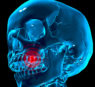 The Perils of Inflammation